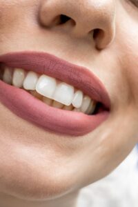 un gros plan de la bouche d'une femme avec des dents blanches